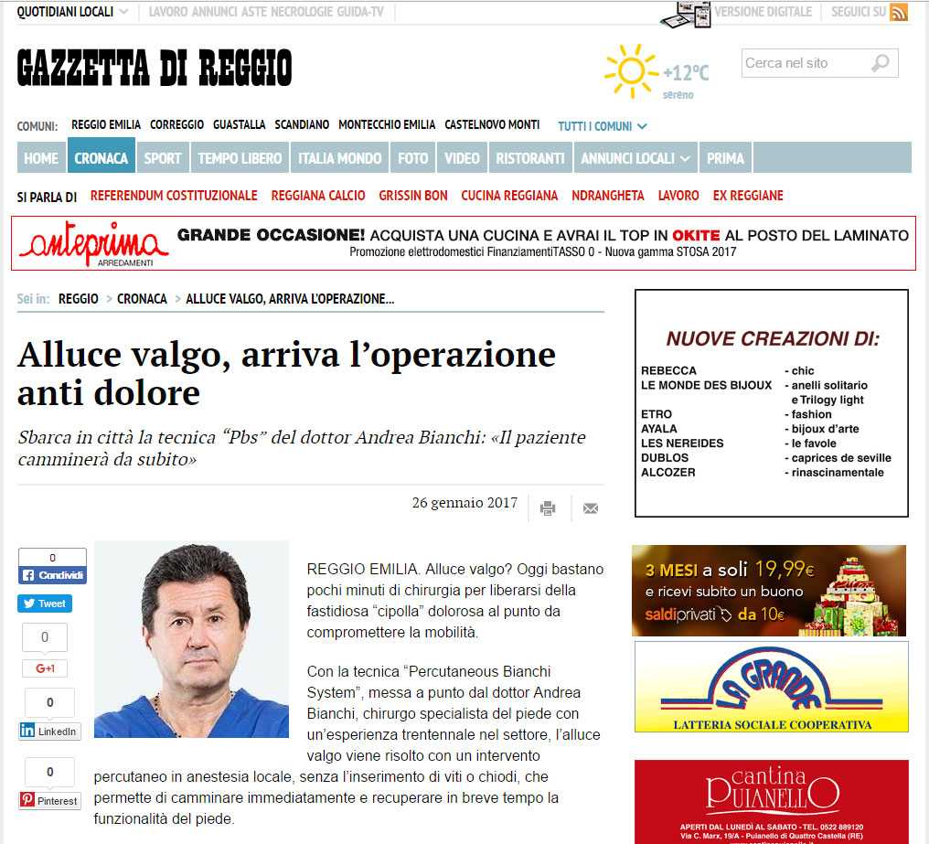 alluce valgo operazione